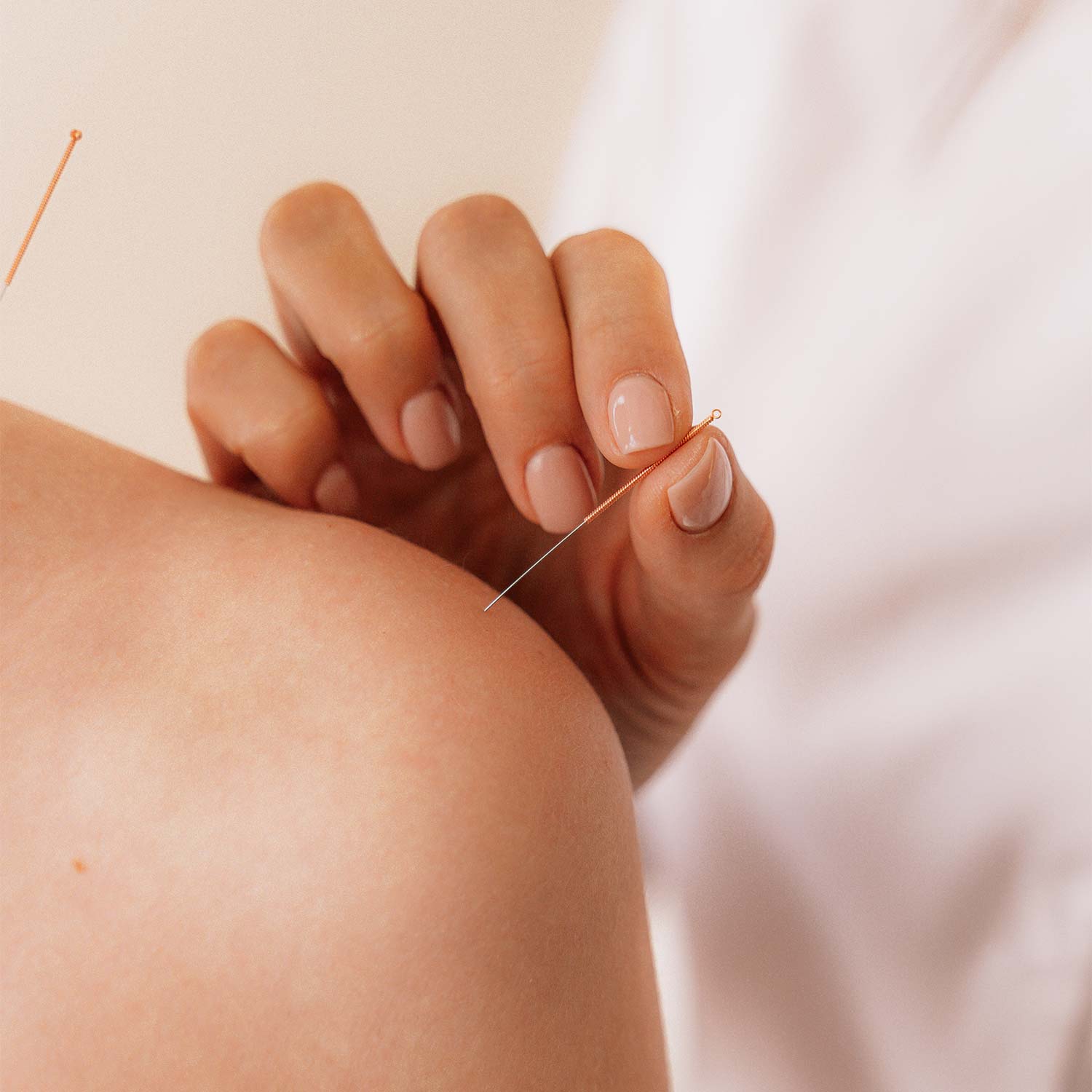 Acupuncture telle que pratiquée au Centre Physio Santé à Genève